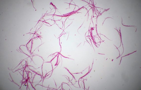 700.000 Mikrofasern werden pro Kleidungsstück und Hauswäsche abgeworfen.